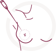 Mia Femtech specialized surgical tools