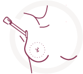 Mia Femtech implant insertion via armpit