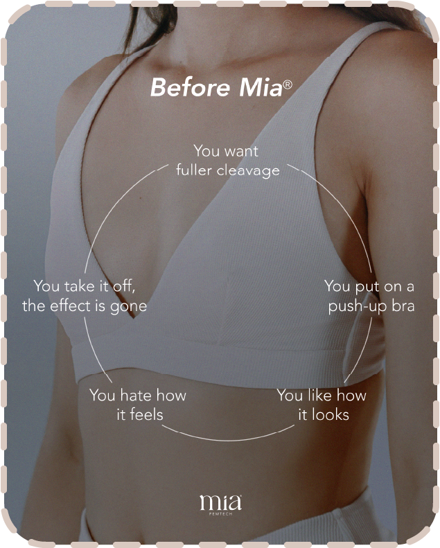 Breast appearance before Mia Femtech harmonization procedure